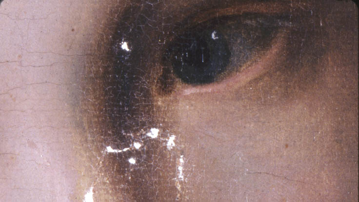 During treatment detail showing small white filled losses or lacune near the figure's eye.